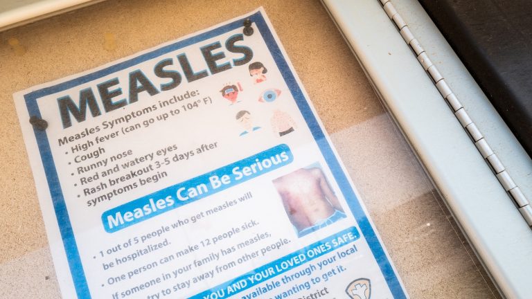 Michigan reports first confirmed measles outbreak since 2019