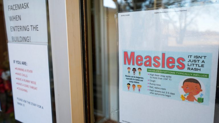 US measles cases hit highest number in 33 years: CDC