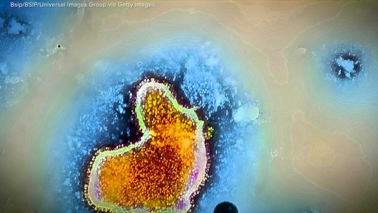 WATCH:  What to know about rare, brain-eating amoeba Naegleria fowleri