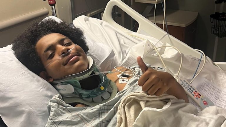 WATCH:  ‘I’m pretty lucky’: Teen struck by lightning as thunderstorms hit Northeast