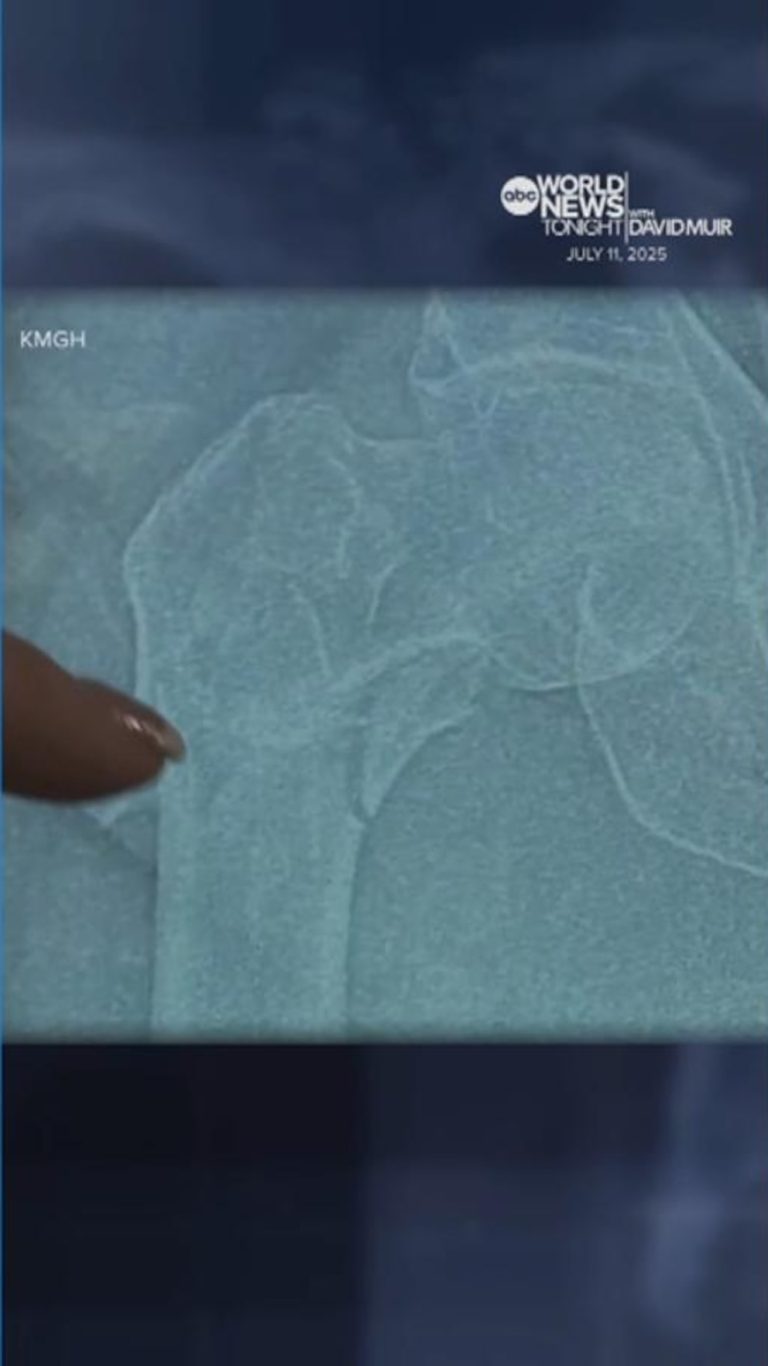 Video Colorado grandmother crawls 14 hours to survive after injury in remote area